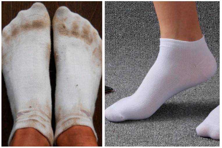 Как отстирать белые носки народными методами и готовыми средствами